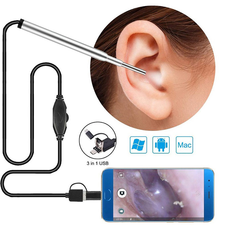 Medical Endoscope Kamera Nzeve Nasal Endoscope Usb Otoscope